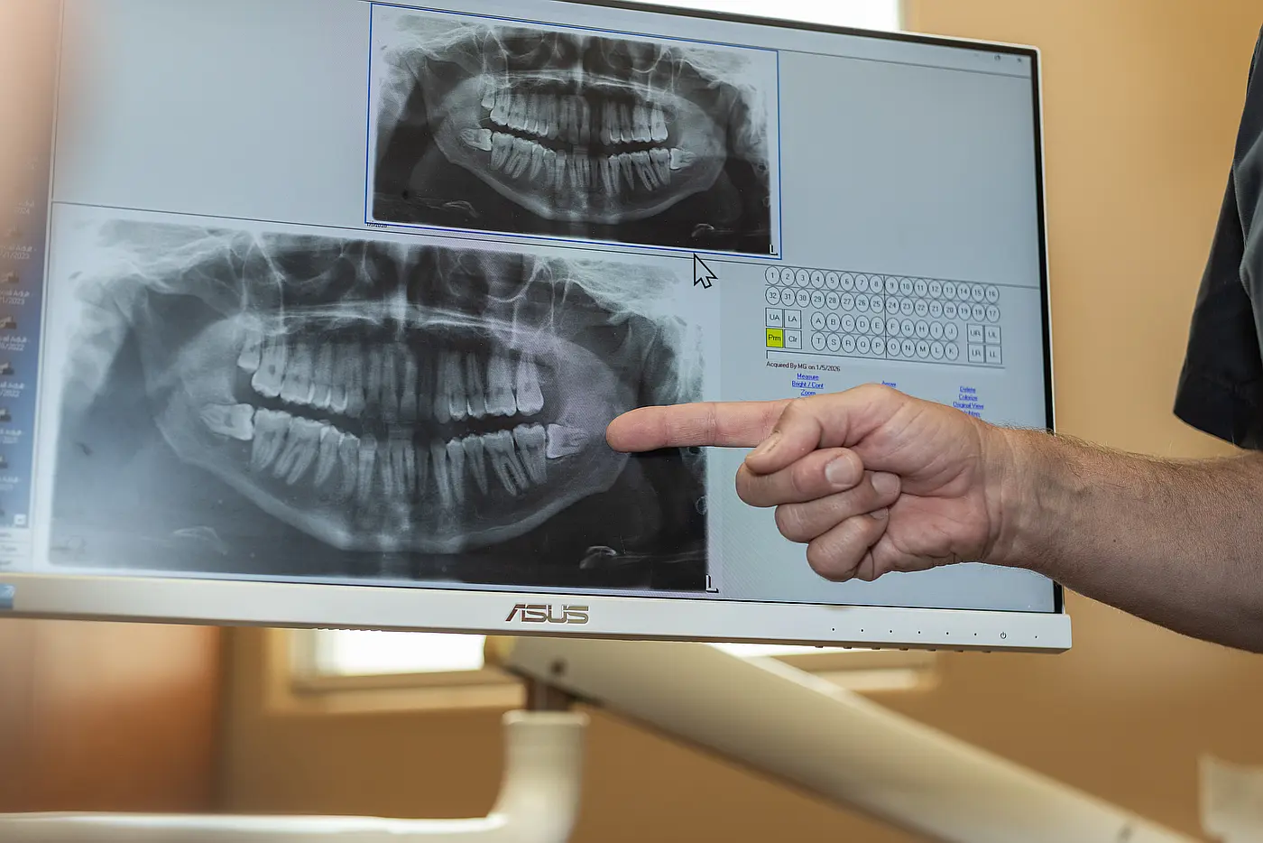 Dental X-ray