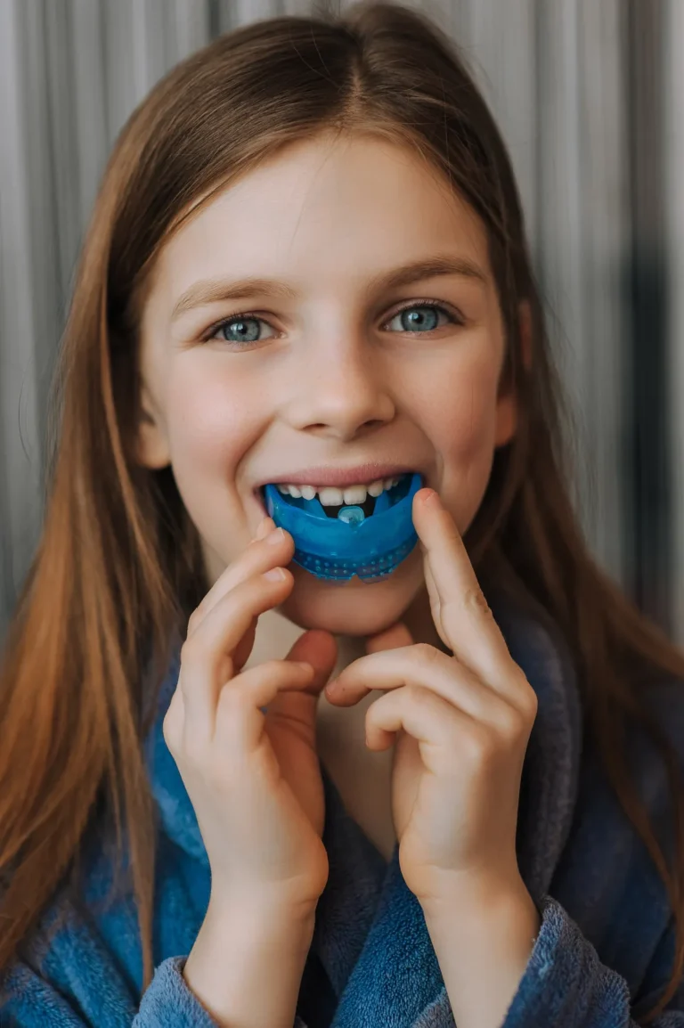 Mouth Guards