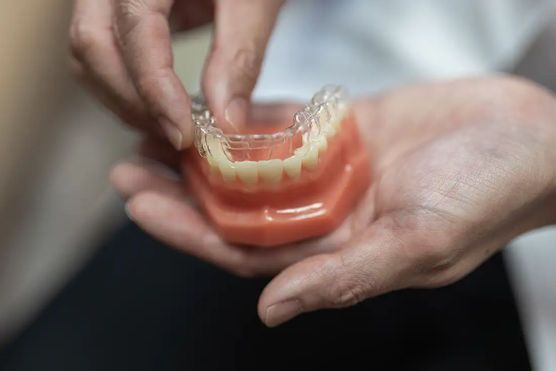 Invisalign Image